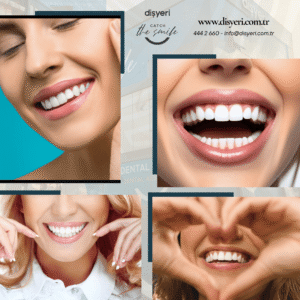 Gülüş Tasarımı Smile Design Dişyeri Grup