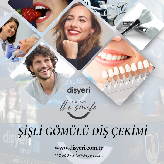 Şişli Gömülü Diş Çekimi Dişyeri Grup