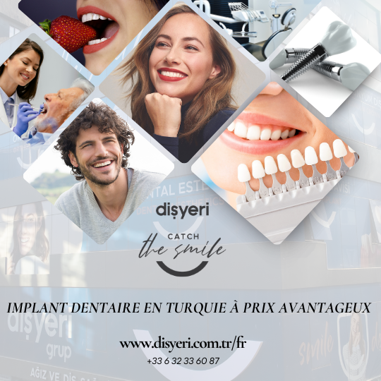 Implant Dentaire en Turquie à Prix Abordable – Devis Gratuit